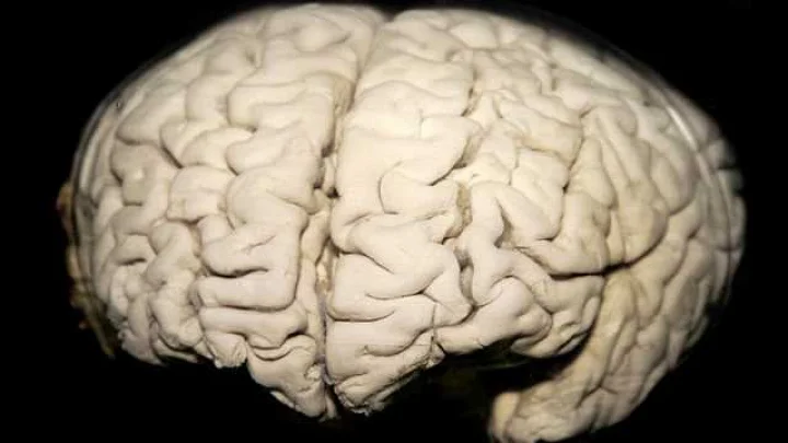 preserve the brain