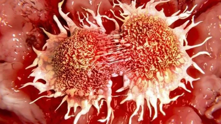 Tobacco Cancer