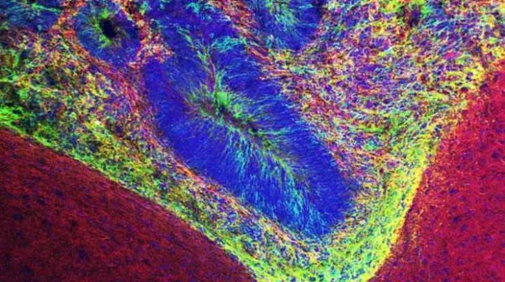 Many neurological disorders