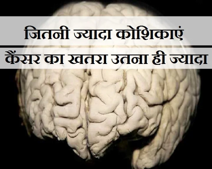 बड़े मस्तिष्क वालों में ज्यादा है कैंसर का खतरा, जानिए कारण