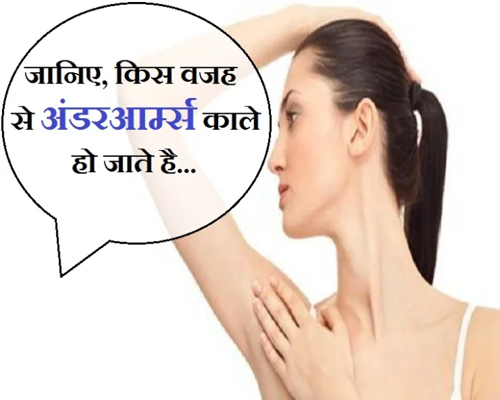 Reasons for dark underarms