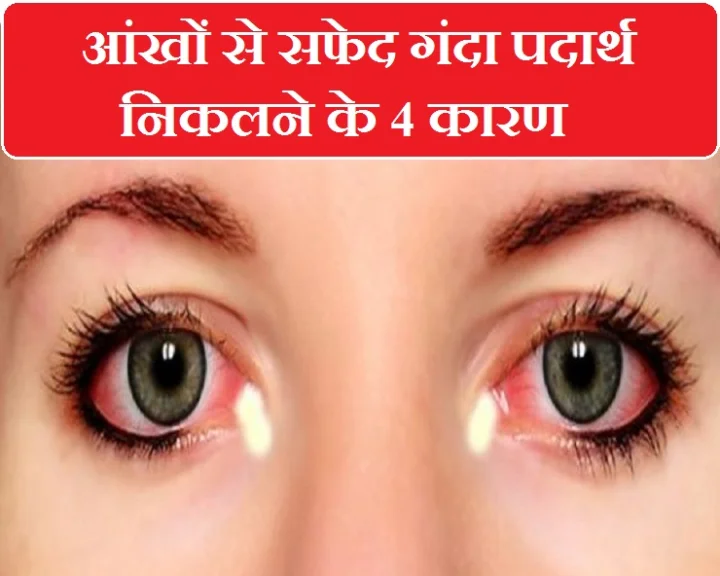 आंखें