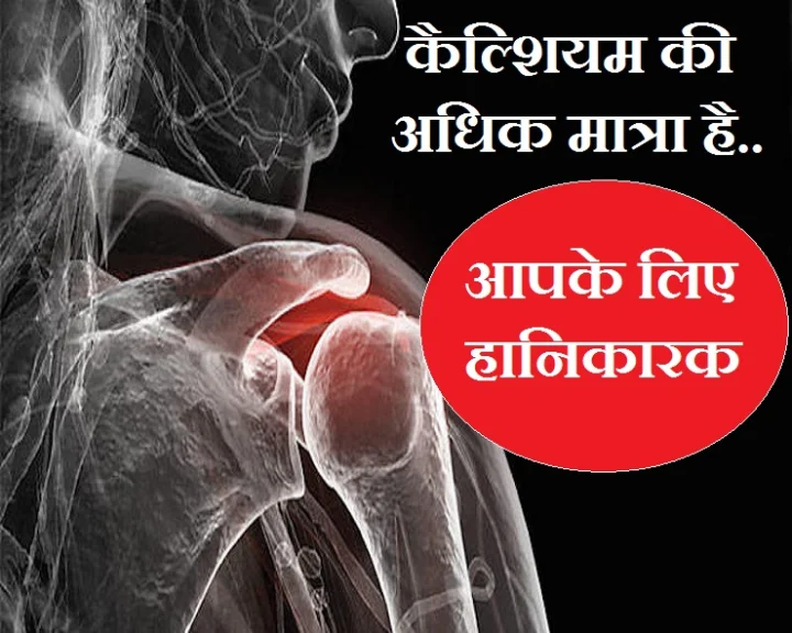 कैल्शि‍यम