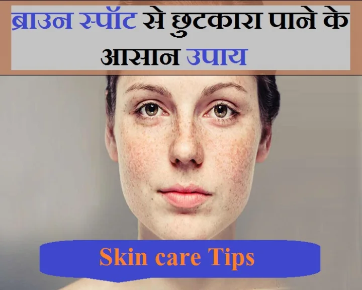 brown spot