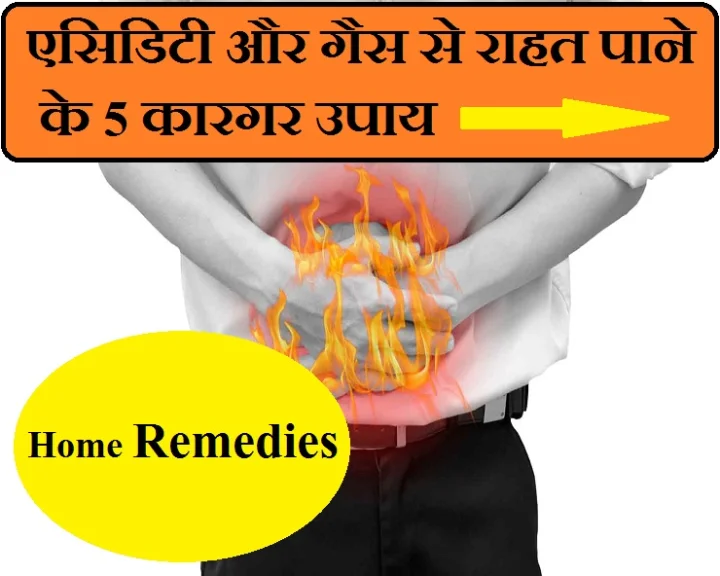 Home remedies