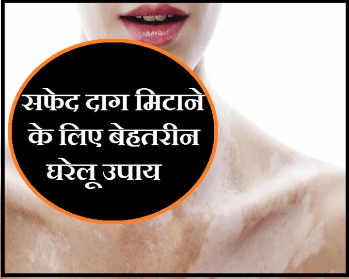 मेलेनिन