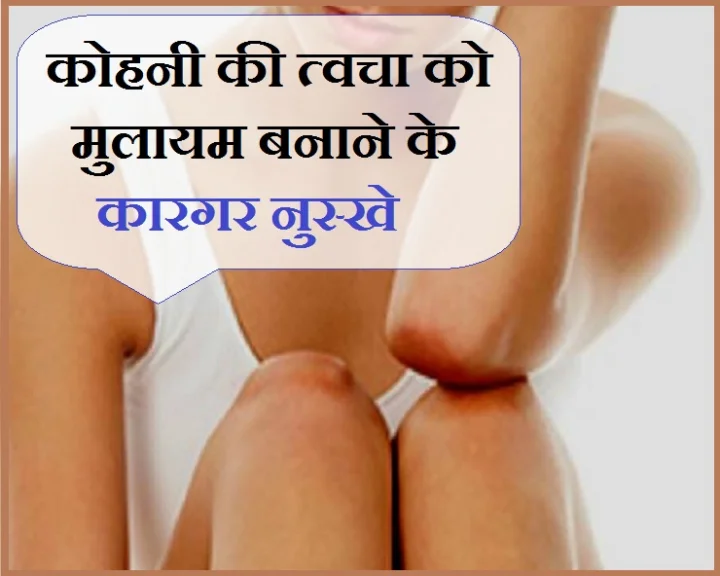 कोहनी की त्वचा को मुलायम और कोमल बनाने के लिए अपनाएं ये घरेलू नुस्खे