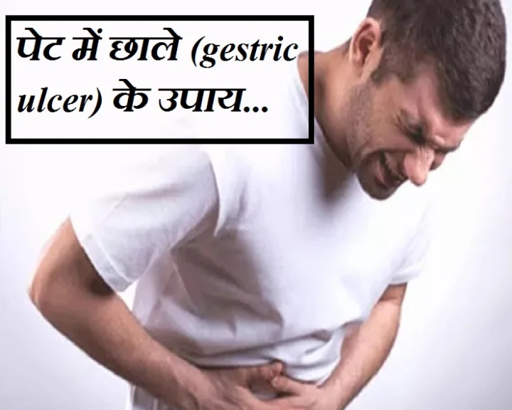 ulcer