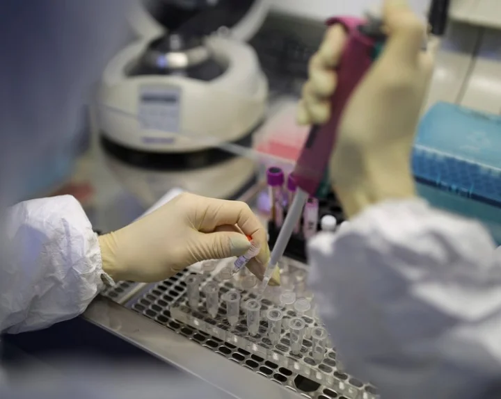 RT-PCR swab