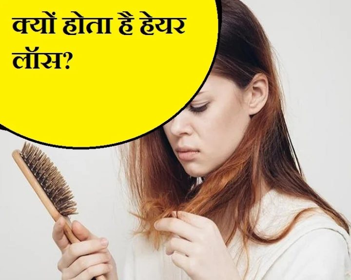 Causes of Hair Loss : क्यों होता है हेयर लॉस, जानिए  वजह