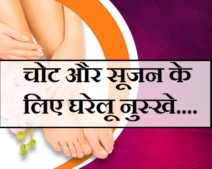 चोट या मोच लगने पर क्या करें