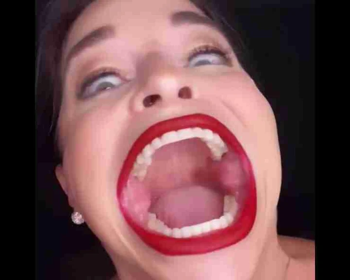 Woman With World's Biggest Mouth