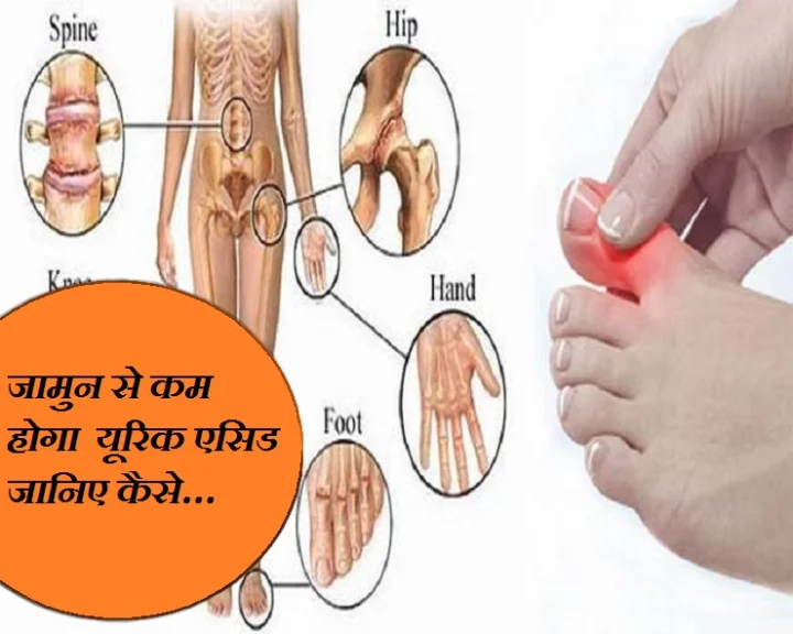 यूरिक एसिड