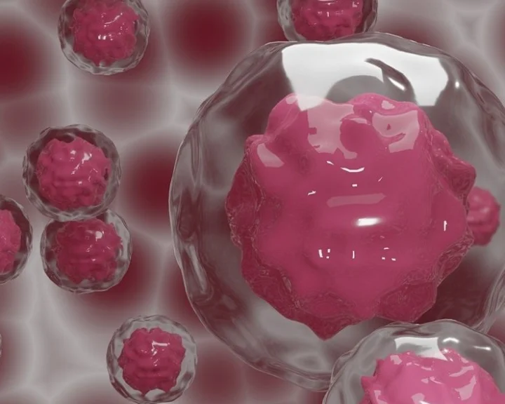 Dostarlimab दवा से कैंसर खत्म! 6 माह के ट्रायल में मिली बड़ी सफलता