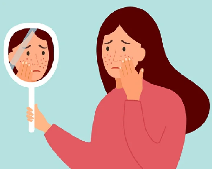 High Cholesterol Symptoms On Face