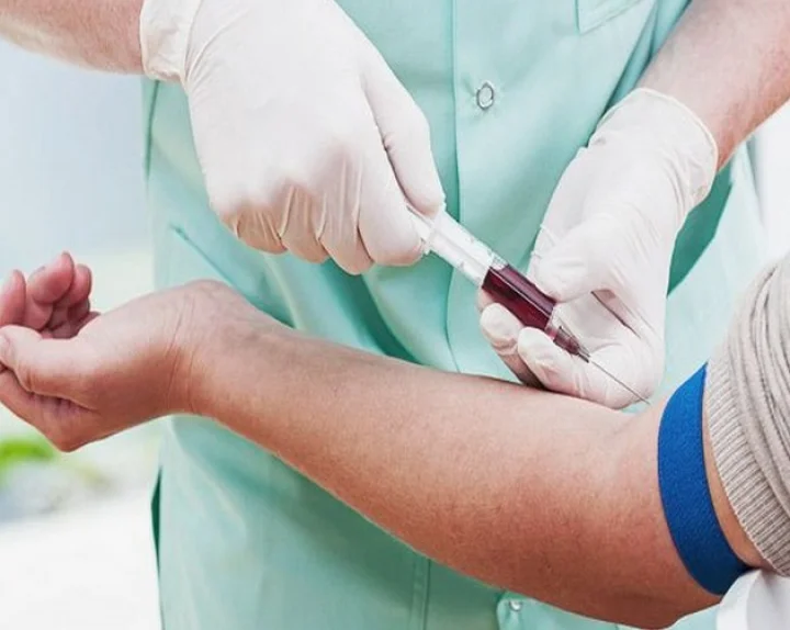 140 prisoners living with HIV
