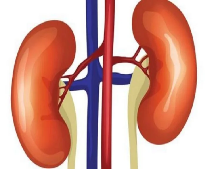 what are the first signs of kidney stones