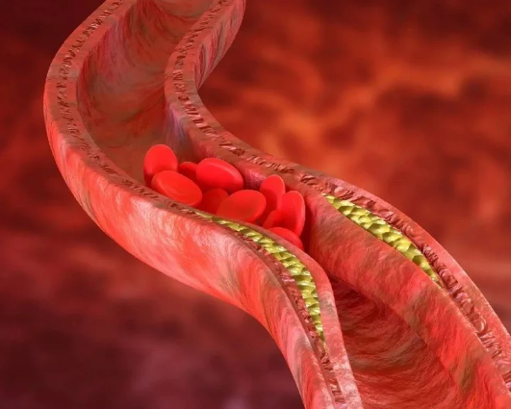 Cholesterol