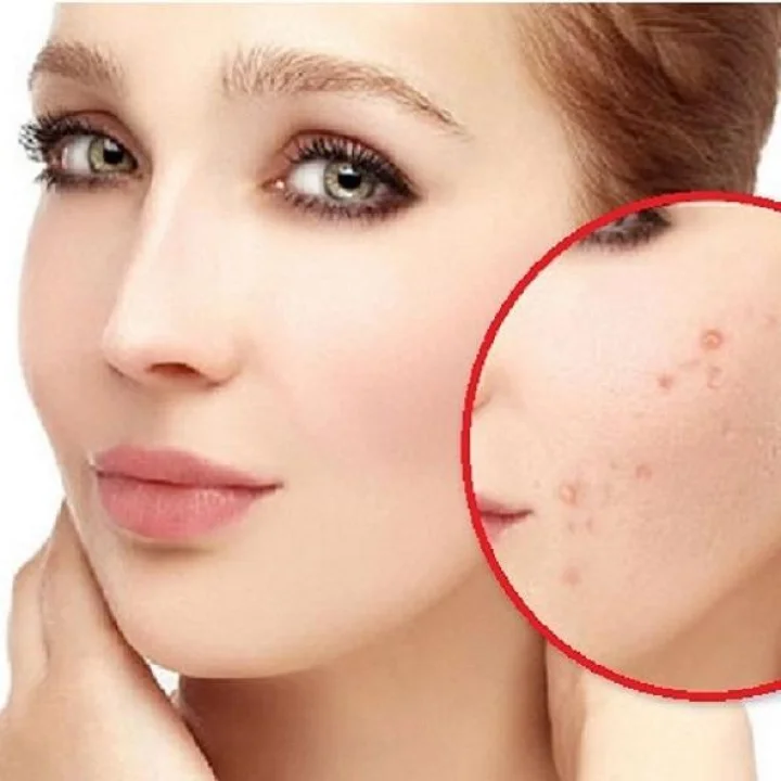 Summer Beauty tips- ઉનાડામાં આ રીતે રાખો સ્કીનને હેલ્દી