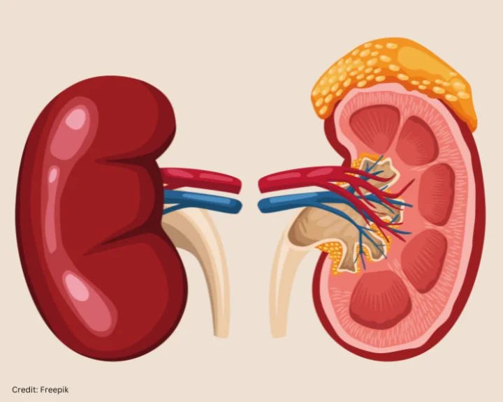 kidney disease symptoms