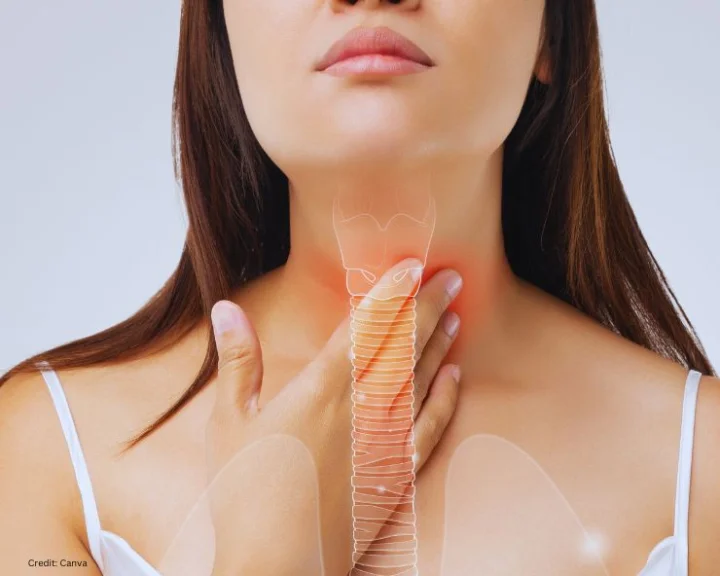 natural treatment for throat infection