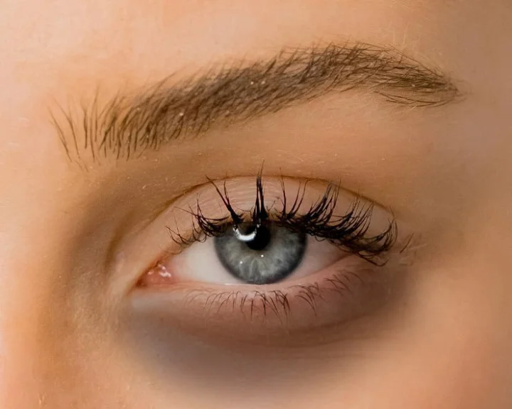 dark circles home made tips