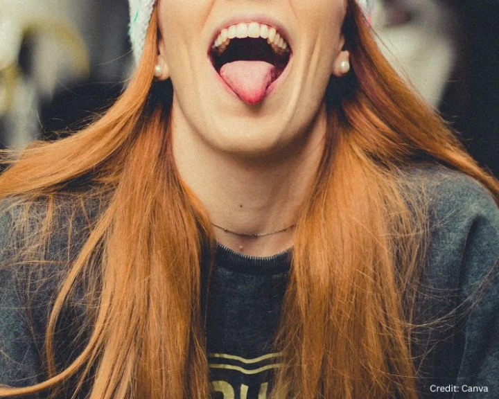 diseases related to tongue