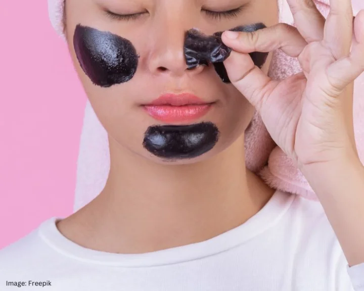 blackheads removal