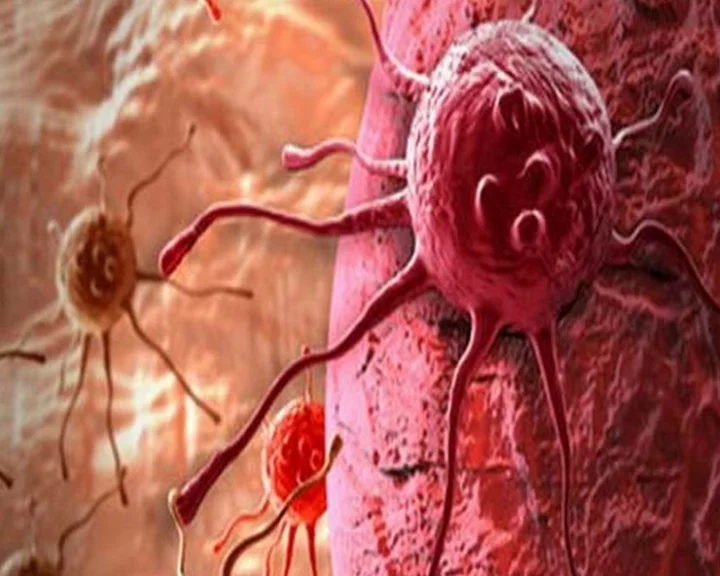 Cervical Cancer Vaccination