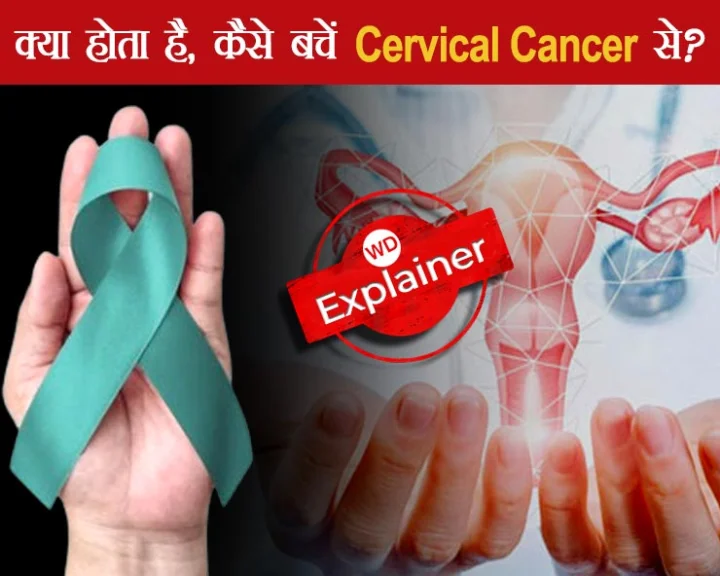 cervical cancer