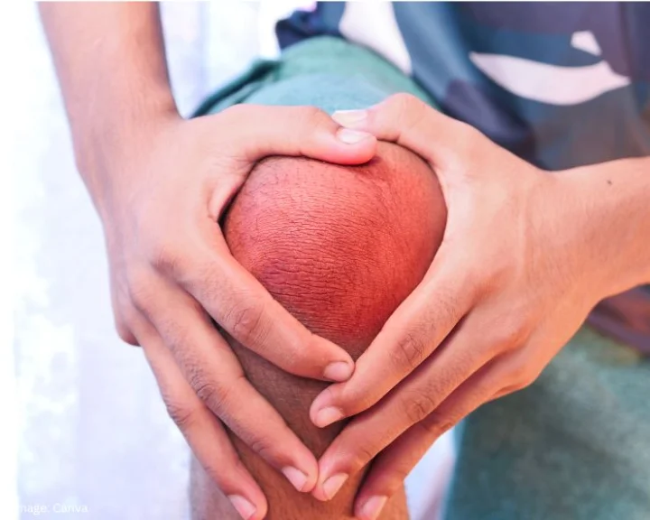 Joint Pain Remedies