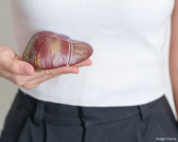 Fatty Liver Disease