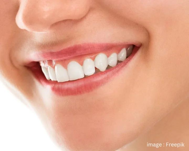 aloe vera gel for teeth whitening