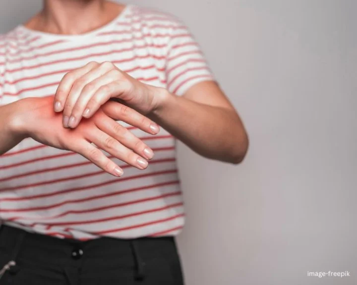 Weak Bone Health
