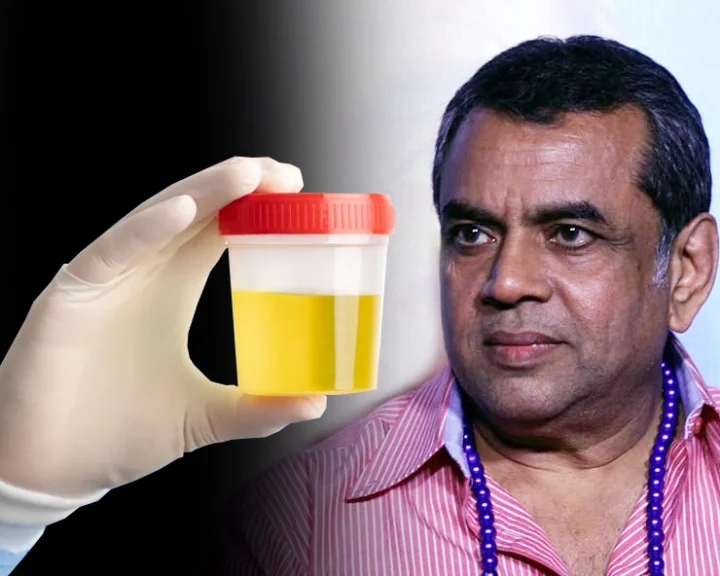 drinking urine