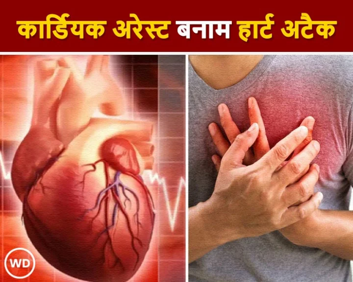 कार्डिएक अरेस्ट और हार्ट अटैक में क्या है अंतर? लक्षण, कारण और कौन है ज्यादा खतरनाक