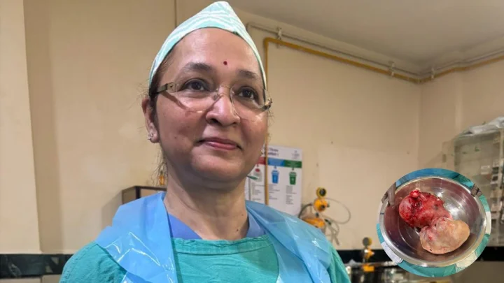 महिला के पेट से निकली फुटबॉल के आकार की विशाल गांठ, इंदौर में सफल सर्जरी