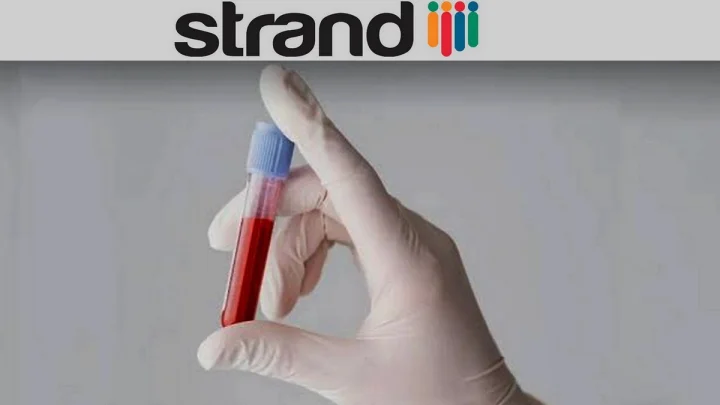 रिलायन्स इंडस्ट्रीजची  स्ट्रँड लाईफ सायन्सेसला कर्करोगाचे लवकर निदान करण्यासाठी पेटंट मिळाले