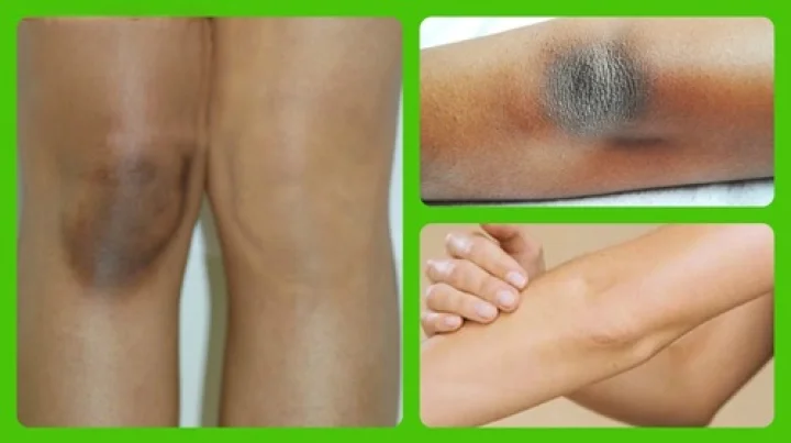 ಬೆಂಗಳೂರು