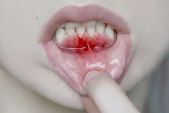 ಬೆಂಗಳೂರು