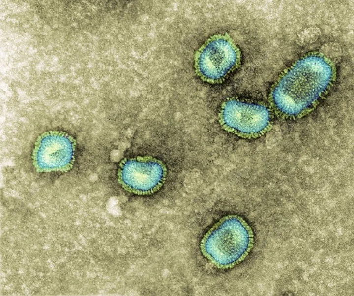 Zoonotic Langya virus