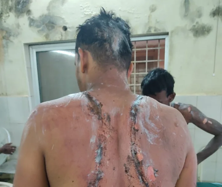 chikkaballapura