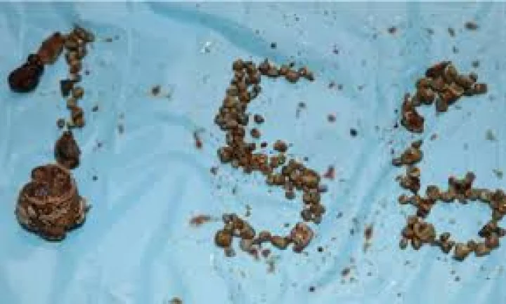 ಹೈದರಾಬಾದ್