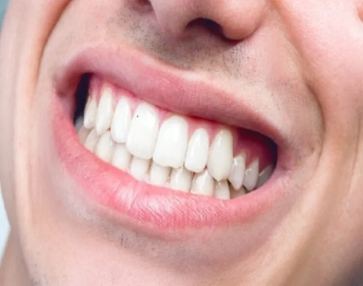 teeth
