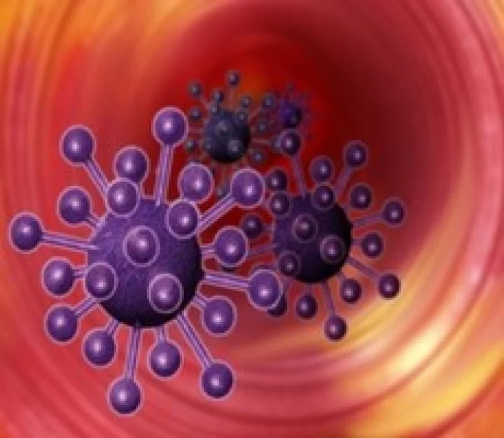 કબજીયાત, મેદસ્વિતા, આધુનિકજીવનશૈલી જેવા કેન્સર થવા માટેનાં નવા કારણો ઉમેરાયા