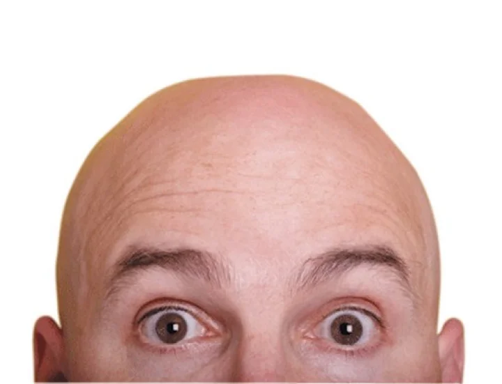 bald head men