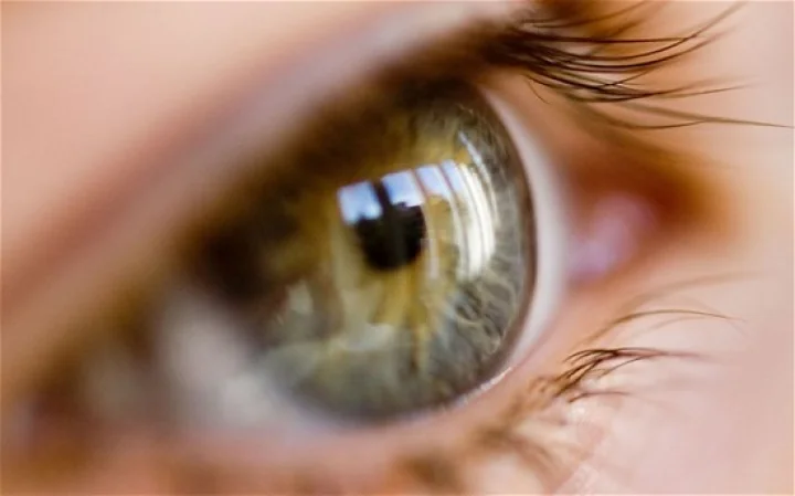 cataract