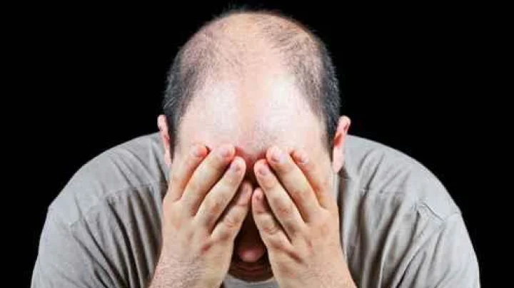 टक्कल घालविण्यासाठी या पाच वस्तूंनी तयार करा तेल