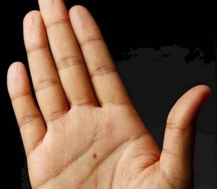 Contemporary acupressure therapy