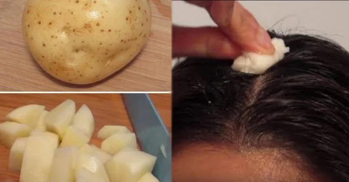 White Hair Treatment